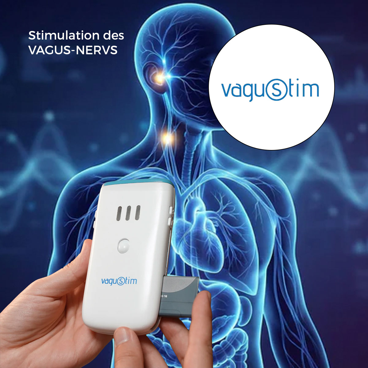Vagusnerv Stimulation